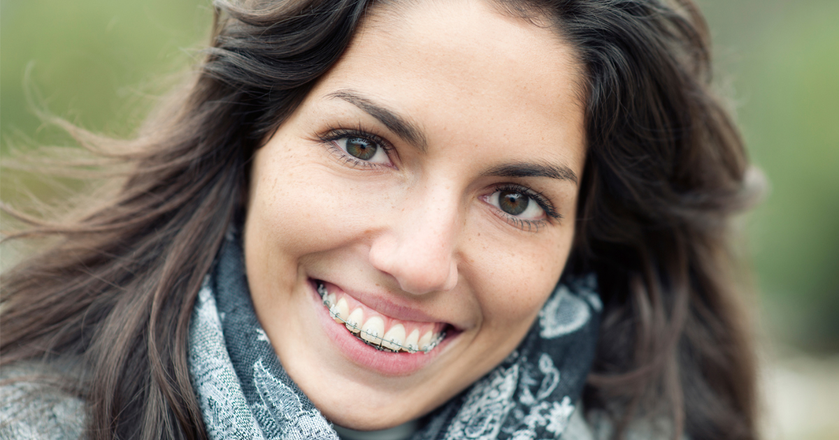 dca-blog_article-17_adults-getting-braces_1200x630